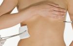 Особенности и методы подтяжки грудных желез