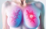 Кисты молочных желёз: причины появления и методы лечения