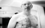 Гемолитическая анемия: что это такое простыми словами