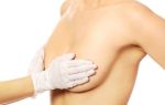 Мастопексия — операция по коррекции груди