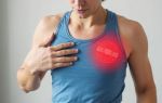 Боль в груди при беге и кардионагрузках: безопасные и опасные признаки, которые важно знать