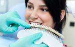 Как проводится отбеливание зубов?