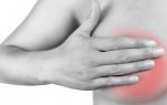 Причины болей грудных желез у женщин