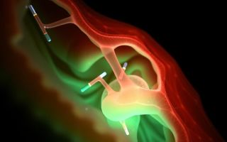 Что такое грыжа шпигелевой линии и как она проявляется