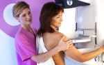 Как правильно подготовиться к маммографии молочных желез