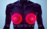 Влияние спортивных травм на здоровье груди: как сохранить силу и комфорт при занятиях спортом