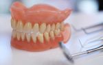 Протезирование зубов — плюсы и минусы