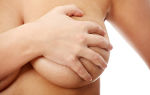 Причины, по которым болят грудные железы у женщин