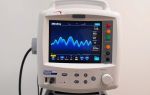 Монитор пациента Mindray: современные технологии для здоровья и безопасности