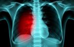 Боль в груди при косолапости: вторичные изменения осанки и почему это важно