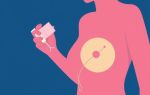 Влияние контрацептивов на здоровье молочных желез: что важно знать каждой женщине